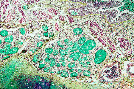 米克罗斯科普100x 古韦德直达米克罗科普肺部组织诊断科学哮喘宏观调查疾病药品组织学图片