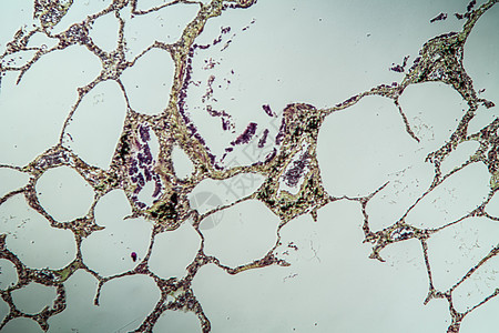 米克罗斯科普100x 古韦德直达米克罗科普肺部康复组织组织学诊断病理科学哮喘药品疾病图片