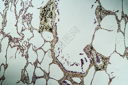 米克罗斯科普100x 古韦德直达米克罗科普诊断药品调查病理组织学科学哮喘疾病宏观组织图片
