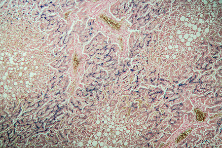 显微镜下的肝脏100x药品科学宏观组织病理疾病调查肝素康复组织学图片
