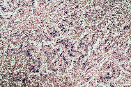 显微镜下的肝脏200x诊断疾病组织学宏观康复药品科学肝素调查病理图片
