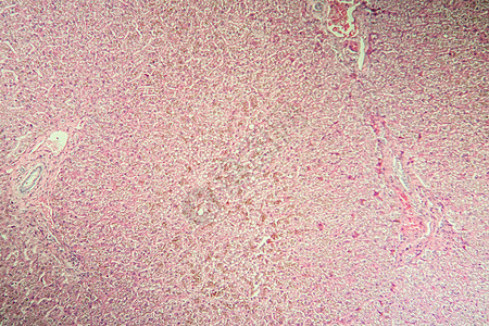 显微镜中肝脏疾病中的比鲁本100x遗传病病理药品科学宏观康复考试诊断组织学调查图片