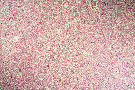 显微镜中肝脏疾病中的比鲁本100x遗传病病理药品科学宏观康复考试诊断组织学调查图片