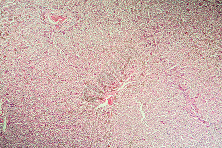 显微镜中肝脏疾病中的比鲁本100x组织学遗传病康复考试宏观科学药品调查病理诊断图片