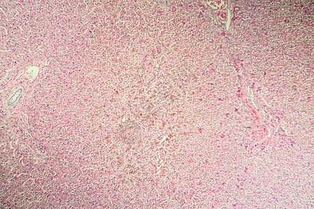 显微镜中肝脏疾病中的比鲁本100x科学考试调查康复病理组织学诊断遗传病宏观药品图片