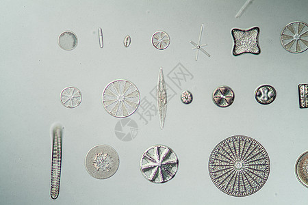 不同种类的二亚原子 100x宏观调查生物学硅藻疾病贝壳植物诊断藻类淡水图片