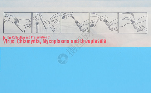 用于病毒 衣原体 支原体和解脲支原体的通用转运培养基和用于鼻咽样本采集的拭子 用于 covid19 的呼吸道病毒检测细菌实验室治图片
