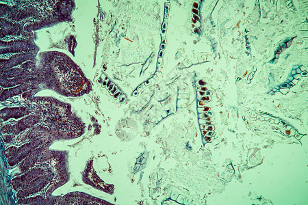 蜜蜂阿米叶痢疾 100x科学动物寄生虫感染微生物小动物疾病宏观蓝色药品图片
