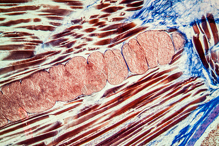 100x 感染肌肉组织肌肉受感染者体内的除菌管蓝色科学寄生虫黑头侥幸蠕虫红色药品囊肿疾病图片