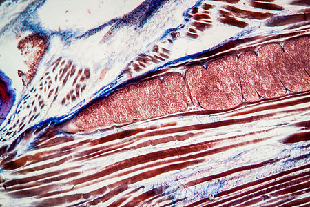 100x 感染肌肉组织肌肉受感染者体内的除菌管蓝色红色宏观囊肿黑头蠕虫科学疾病寄生虫侥幸图片