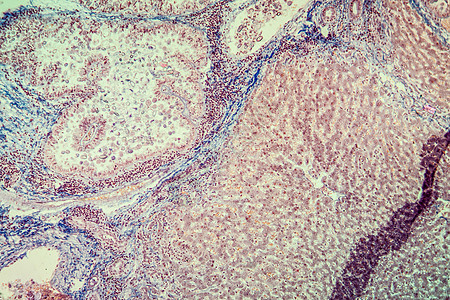 100x 显微镜下肝脏组织囊肿细胞宏观药品兔子孢子虫放大镜动物寄生虫球虫病球虫图片