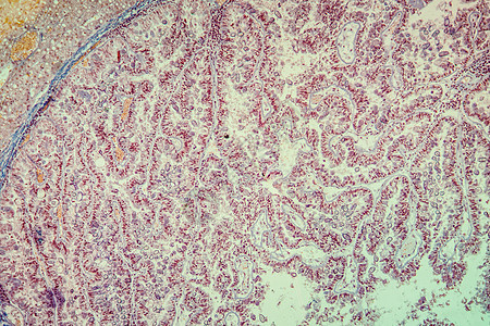 100x 显微镜下肝脏组织囊肿兔子细胞宏观科学放大镜疾病孢子虫动物寄生虫球虫病图片