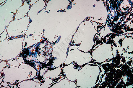 显微镜下的炭粉尘肺组织 100x协会强制放大镜细胞矿工药品尘肺宏观科学肺炎图片