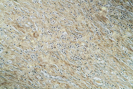 下巴的活性蛋白质蓝色疾病宏观组织细胞骨头科学放大镜药品菌类图片