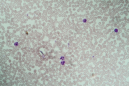 红血和白白血细胞 400x白细胞红细胞科学蓝色活力显微术果汁宏观血小板放大镜图片