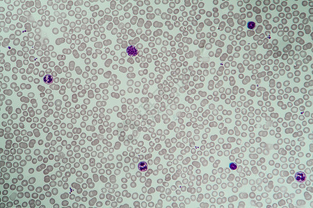 红血和白白血细胞 400x白细胞显微术果汁红细胞科学宏观蓝色放大镜活力血小板图片