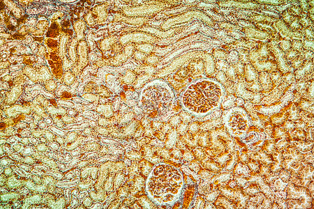Billirubin肾脏疾病组织 100x宏观蓝色肾细胞病理肾小体细胞药品科学放大镜黄疸图片