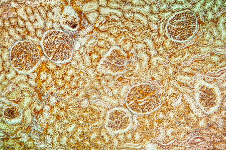 Billirubin肾脏疾病组织 100x科学肾细胞黄疸病理药品放大镜宏观肾小体蓝色细胞图片