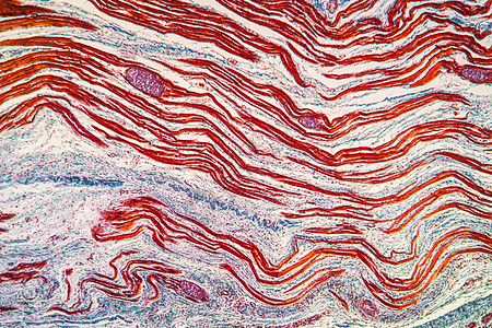 肌肉中附虫鳍寄生虫 100x细胞疾病组织蓝色放大镜幼虫宏观科学病理图片