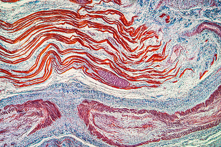 肌肉中附虫鳍寄生虫 100x科学蓝色疾病组织放大镜幼虫病理宏观细胞图片