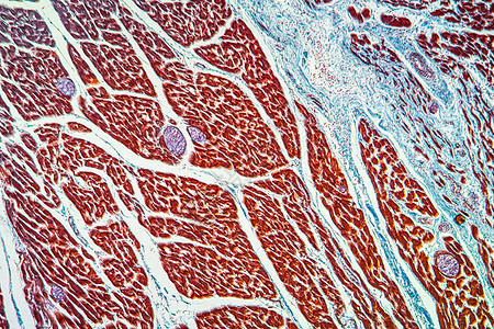 肌肉中附虫鳍寄生虫 100x细胞蓝色幼虫组织宏观放大镜病理科学疾病图片