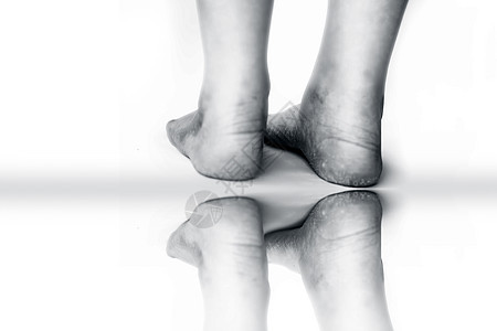 女性腿或高跟鞋 穿着破碎的高跟鞋 在白色上与白隔绝 并反射修脚皮肤科皮炎卫生组织身体脚尖裂缝疾病脚跟图片