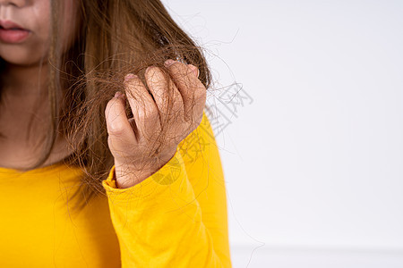 毛发掉落的问题 紧身手握有问题头发 保健医疗或日常生活概念秃头女士癌症压力梳子损失秃顶化疗女性治疗图片