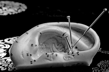 戴耳型针刺针康复卫生草本植物宏观黑色治疗身体保健白色黑与白图片