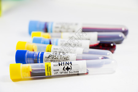 H1N1猪流感 诊断和化验 血液测试管样本 文本和信件预防疾病技术液体血液学治疗感染实验室病人唱歌图片