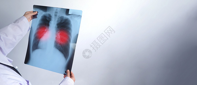 中年亚洲女性医生站立和持有X光F癌症男人病人考试临床扫描药品电影ct骨骼图片