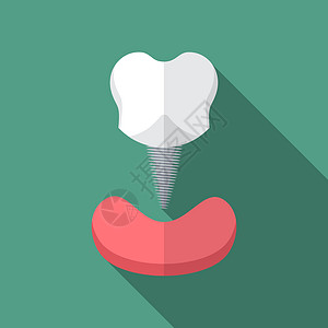 设计平坦的现代矢量说明 牙齿植入图标用长阴影图片