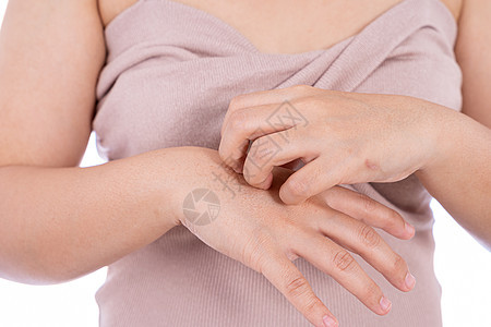 女性在抓手时孤立的白种背景 医疗 为广告概念提供保健服务病变皮炎皮肤疾病划痕刺激牌匾裂缝补丁症状图片