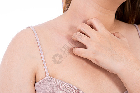 女性在胸前抓破孤立的白种背景 医疗 为广告概念提供保健牌匾皮炎皮肤医生病人湿疹胸部感染伤口刺激图片