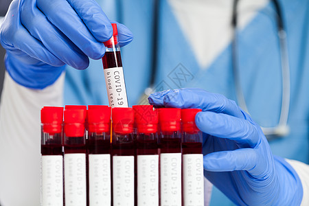 医生用Corona病毒病人的血泡抽出一个红试管图片