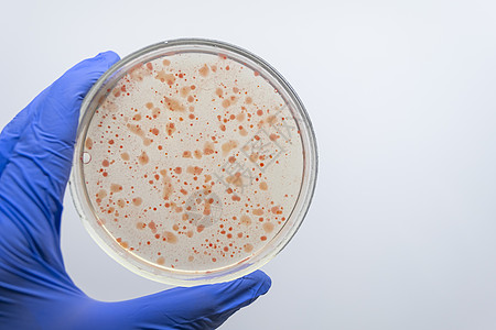 科学家手握着一种含有红色细菌的Petri盘子图片