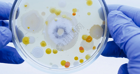 被一个戴着蓝手套的科学家 保管着的宠物盘上的细菌图片