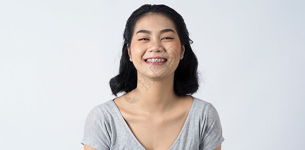 戴牙套和隐形眼镜的亚洲青少年女性牙套微笑牙医女孩女士治疗金属牙齿卫生矫正口服图片