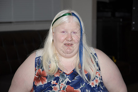 白化阿尔比诺妇女穿着彩色头发图片