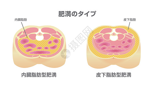 日本的肥胖插图类型 腹部剖视图 内脏脂肪 皮下脂肪横截面饮食损失卫生数字男性代谢保健疾病重量图片