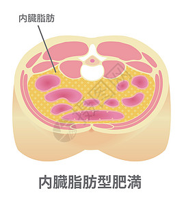 日本的肥胖插图类型 腹部剖视图内脏 fa脂肪科学医疗数字卫生损失保健横截面药品重量图片