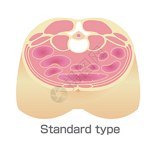 肥胖例证的类型 腹部剖视图 健康体型 标准型饮食药品损失男人糖尿病生活方式器官疾病重量横截面图片