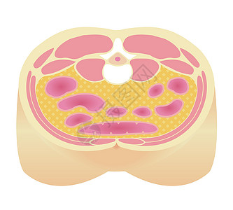 日本的肥胖插图类型 腹部剖视图内脏 fa药品保健饮食男性代谢重量糖尿病横截面医疗生物学图片