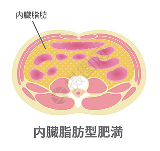日本的肥胖插图类型 腹部剖视图内脏 fa脂肪卫生生物学药品身体科学器官代谢损失疾病图片