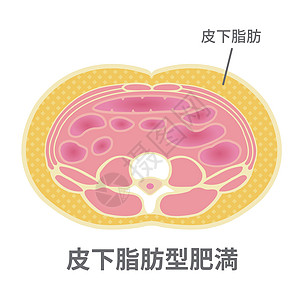 日本的肥胖插图类型 腹部剖视图皮下脂肪药品卫生重量器官科学保健男性男人生物学代谢图片