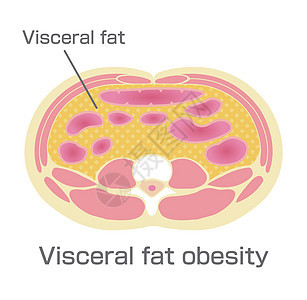 日本的肥胖插图类型 腹部剖视图内脏 fa科学身体疾病保健医疗代谢数字饮食脂肪卫生图片
