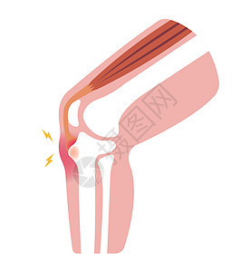 膝关节部分它制作图案胫骨解剖学骨头髌骨身体插图器官肌肉科学运动图片