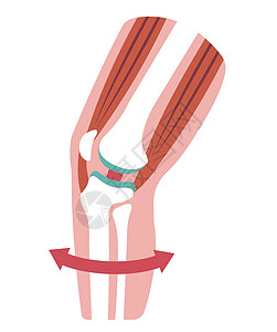 膝关节剖面图替代品插图骨关节炎生物骨科药品女士骨骼治疗疾病图片