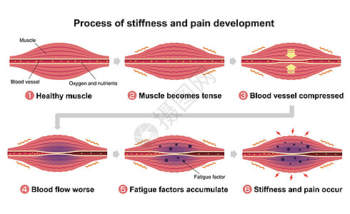 肌肉僵硬和疼痛圆圈类型它制作图案的过程身体落枕肩膀生物学药品痛苦疾病纤维组织器官图片