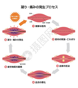 肌肉僵硬和疼痛圆圈类型它制作图案的过程解剖学器官身体女士肩膀组织科学药品落枕痛苦图片