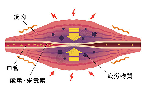 疲劳因素累积 肌肉和血管的平面插图按摩纤维疼痛疾病落枕药品痛苦生物学身体肩膀图片